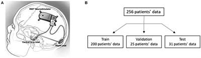 Non-linear Embedding Methods for Identifying Similar Brain Activity in 1 Million iEEG Records Captured From 256 RNS System Patients